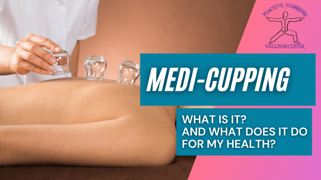 Discover the Benefits of Medicupping