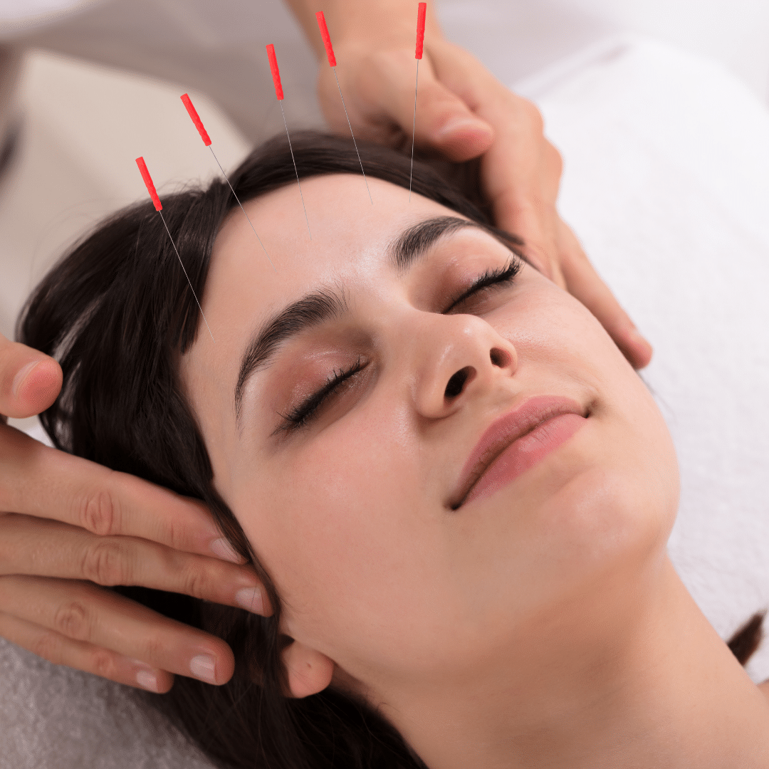 acupuncture and facial combo acupuncture and facial combo